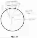 Fig. 16 - Acoustic orthopedic tracking system and methods