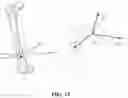 Fig. 31 - Acoustic orthopedic tracking system and methods