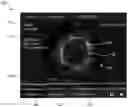 Fig. 01 - SYSTEMS, DEVICES, AND METHODS FOR DISPLAYING MULTIPLE INTRALUMINAL IMAGES IN LUMINAL ASSESSMENT WITH MEDICAL IMAGING
