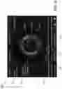 Fig. 07 - SYSTEMS, DEVICES, AND METHODS FOR DISPLAYING MULTIPLE INTRALUMINAL IMAGES IN LUMINAL ASSESSMENT WITH MEDICAL IMAGING