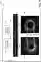 Fig. 09 - SYSTEMS, DEVICES, AND METHODS FOR DISPLAYING MULTIPLE INTRALUMINAL IMAGES IN LUMINAL ASSESSMENT WITH MEDICAL IMAGING