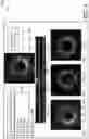 Fig. 10 - SYSTEMS, DEVICES, AND METHODS FOR DISPLAYING MULTIPLE INTRALUMINAL IMAGES IN LUMINAL ASSESSMENT WITH MEDICAL IMAGING