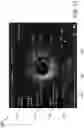 Fig. 12 - SYSTEMS, DEVICES, AND METHODS FOR DISPLAYING MULTIPLE INTRALUMINAL IMAGES IN LUMINAL ASSESSMENT WITH MEDICAL IMAGING