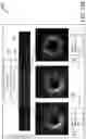 Fig. 13 - SYSTEMS, DEVICES, AND METHODS FOR DISPLAYING MULTIPLE INTRALUMINAL IMAGES IN LUMINAL ASSESSMENT WITH MEDICAL IMAGING