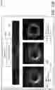 Fig. 14 - SYSTEMS, DEVICES, AND METHODS FOR DISPLAYING MULTIPLE INTRALUMINAL IMAGES IN LUMINAL ASSESSMENT WITH MEDICAL IMAGING