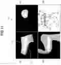 Fig. 08 - ULTRASOUND DIAGNOSIS APPARATUS AND IMAGE PROCESSING METHOD