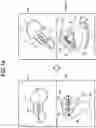 Fig. 11 - ULTRASOUND DIAGNOSIS APPARATUS AND IMAGE PROCESSING METHOD