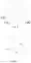 Fig. 04 - Intravascular memory metal puncture needle and use thereof