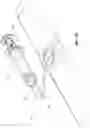 Fig. 06 - SUCTION CLOSURE DEVICES AND METHODS