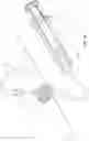 Fig. 22 - SUCTION CLOSURE DEVICES AND METHODS