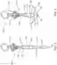Fig. 02 - Laparoscopic fascial closure system