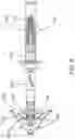 Fig. 06 - Laparoscopic fascial closure system