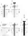 Fig. 06 - SYSTEMS AND METHODS OF STEERABLE ELONGATE DEVICE
