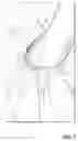 Fig. 07 - Eyelid flipper tool