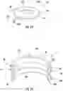 Fig. 07 - Lumen reinforcement and anchoring system