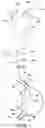 Fig. 10 - Lumen reinforcement and anchoring system