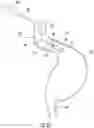 Fig. 12 - Lumen reinforcement and anchoring system