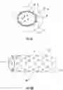 Fig. 14 - Lumen reinforcement and anchoring system