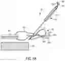 Fig. 07 - Methods and devices for knotless suture anchoring