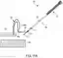 Fig. 20 - Methods and devices for knotless suture anchoring
