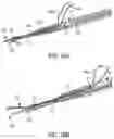 Fig. 31 - Methods and devices for knotless suture anchoring