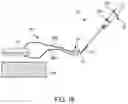 Fig. 32 - Methods and devices for knotless suture anchoring