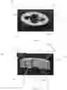 Fig. 02 - Suture crimp plate