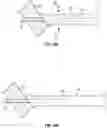 Fig. 18 - NEEDLE FOR DELIVERY OF DERMAL FILLER THREADS