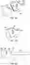 Fig. 57 - Devices and methods for facilitating ejection of surgical fasteners from cartridges