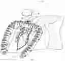 Fig. 01 - Apparatus for suture management and methods thereof