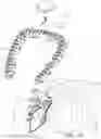 Fig. 07 - Apparatus for suture management and methods thereof