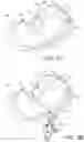 Fig. 09 - Apparatus for suture management and methods thereof