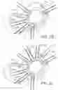 Fig. 13 - Apparatus for suture management and methods thereof