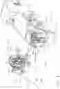 Fig. 04 - Surgical instrument comprising a lockable battery housing
