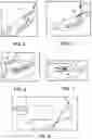 Fig. 05 - Methods and devices for forming a tissue fold