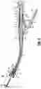 Fig. 03 - Surgical stapling device with audible indicator mechanism