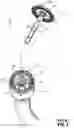 Fig. 04 - Circular stapling device with alignment splines