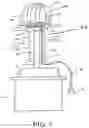 Fig. 03 - Mesh cap for ameliorating outpouchings