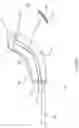 Fig. 42 - Systems for and methods of preparing a sacroiliac joint for fusion