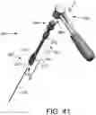 Fig. 47 - Systems for and methods of preparing a sacroiliac joint for fusion
