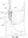 Fig. 67 - Systems for and methods of preparing a sacroiliac joint for fusion