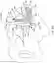Fig. 73 - Systems for and methods of preparing a sacroiliac joint for fusion