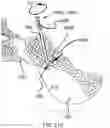 Fig. 76 - Systems for and methods of preparing a sacroiliac joint for fusion