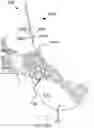 Fig. 83 - Systems for and methods of preparing a sacroiliac joint for fusion