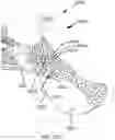 Fig. 85 - Systems for and methods of preparing a sacroiliac joint for fusion