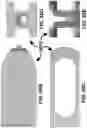 Fig. 90 - Systems for and methods of preparing a sacroiliac joint for fusion