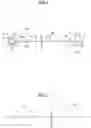 Fig. 02 - THREE FILTERS CATHETER FOR BRAIN PROTECTION AND METHOD