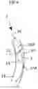 Fig. 06 - THREE FILTERS CATHETER FOR BRAIN PROTECTION AND METHOD