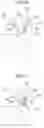 Fig. 07 - THREE FILTERS CATHETER FOR BRAIN PROTECTION AND METHOD