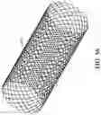 Fig. 60 - Axial lengthening thrombus capture system